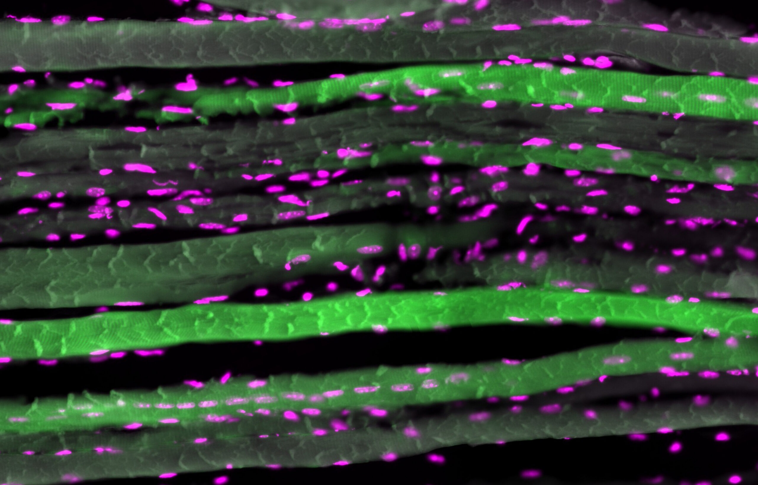 New study questions the role of protein in muscle growth